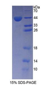 AGTR1 / AT1 Receptor Protein - Recombinant  Angiotensin II Receptor 1 By SDS-PAGE