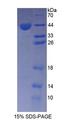 AGTR1 / AT1 Receptor Protein - Recombinant  Angiotensin II Receptor 1 By SDS-PAGE