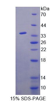 AGXT2 Protein - Recombinant Alanine Glyoxylate Aminotransferase 2 (AGXT2) by SDS-PAGE