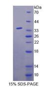 AGXT2 Protein - Recombinant Alanine Glyoxylate Aminotransferase 2 (AGXT2) by SDS-PAGE