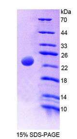 AK2 / Adenylate Kinase 2 Protein - Recombinant  Adenylate Kinase 2 By SDS-PAGE