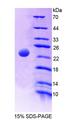 AK2 / Adenylate Kinase 2 Protein - Recombinant  Adenylate Kinase 2 By SDS-PAGE