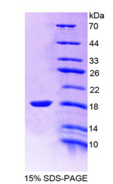 ALK3 / BMPR1A Protein - Recombinant Bone Morphogenetic Protein Receptor 1A By SDS-PAGE