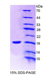 ALK3 / BMPR1A Protein - Recombinant Bone Morphogenetic Protein Receptor 1A By SDS-PAGE