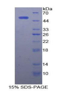 Alpha-Fetoprotein Protein - Recombinant Alpha-Fetoprotein By SDS-PAGE