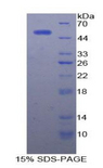 Alpha-Fetoprotein Protein - Recombinant Alpha-Fetoprotein By SDS-PAGE