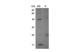 Alpha-Fetoprotein Protein - Recombinant Rat Alpha-fetoprotein Protein (His Tag)-Elabscience