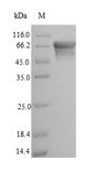 ALPL / Alkaline Phosphatase Protein - (Tris-Glycine gel) Discontinuous SDS-PAGE (reduced) with 5% enrichment gel and 15% separation gel.