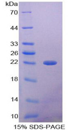 AMBP  Protein - Recombinant Alpha-1-Microglobulin/Bikunin Precursor By SDS-PAGE