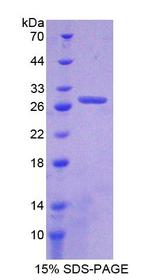 ANGPT4 / Angiopoietin-4 Protein - Recombinant  Angiopoietin 4 By SDS-PAGE
