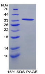 ANGPTL1 Protein - Recombinant Angiopoietin Like Protein 1 By SDS-PAGE