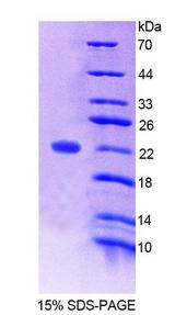 ANGPTL4 Protein - Recombinant Angiopoietin Like Protein 4 By SDS-PAGE