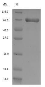 ANPEP / CD13 Protein - (Tris-Glycine gel) Discontinuous SDS-PAGE (reduced) with 5% enrichment gel and 15% separation gel.