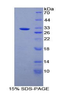ANPEP / CD13 Protein - Recombinant Alanine Aminopeptidase By SDS-PAGE