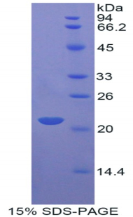 APOD / Apolipoprotein D Protein - Recombinant Apolipoprotein D By SDS-PAGE
