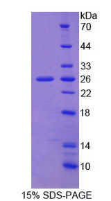 APPBP2 Protein - Recombinant Amyloid Beta Precursor Protein Binding Protein 2 By SDS-PAGE