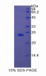 AR / Androgen Receptor Protein - Recombinant Androgen Receptor By SDS-PAGE