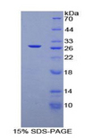ARA55 / HIC-5 Protein - Recombinant Transforming Growth Factor Beta 1 Induced Transcript 1 By SDS-PAGE
