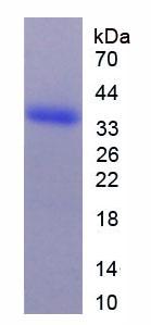 ARG2 / Arginase 2 Protein - Recombinant Arginase II By SDS-PAGE