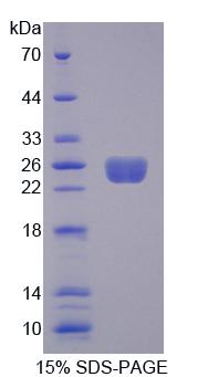 ARHGEF7 Protein - Recombinant Rho Guanine Nucleotide Exchange Factor 7 By SDS-PAGE