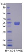 ARHGEF7 Protein - Recombinant Rho Guanine Nucleotide Exchange Factor 7 By SDS-PAGE