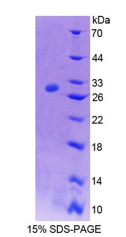 ATP1B4 Protein - Recombinant  ATPase, Na+/K+ Transporting Beta 4 Polypeptide By SDS-PAGE