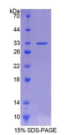 AURKC / Aurora C Protein - Recombinant  Aurora Kinase C By SDS-PAGE