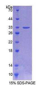 AURKC / Aurora C Protein - Recombinant  Aurora Kinase C By SDS-PAGE