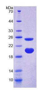 AVPI1 Protein - Recombinant Arginine Vasopressin Induced Protein 1 (AVPI1) by SDS-PAGE