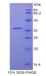 AZGP1 / ZAG Protein - Recombinant Alpha-2-Glycoprotein 1, Zinc Binding By SDS-PAGE