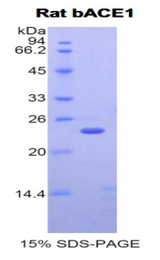 BACE1 / BACE Protein - Recombinant Beta-Site APP Cleaving Enzyme 1 By SDS-PAGE