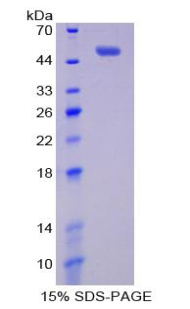 BAFF Receptor / CD268 Protein - Recombinant B-Cell Activation Factor Receptor By SDS-PAGE