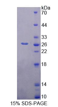 BAG1 / BAG-1 Protein - Recombinant Bcl2 Associated Athanogene 1 (BAG1) by SDS-PAGE