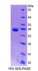 BCAT2 Protein - Recombinant Branched Chain Aminotransferase 2, Mitochondrial (BCAT2) by SDS-PAGE