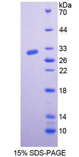 BCHE / Cholinesterase Protein - Recombinant  Butyrylcholinesterase By SDS-PAGE