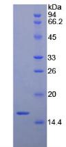 BDNF Protein - Recombinant Brain Derived Neurotrophic Factor By SDS-PAGE