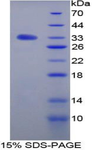 Betaglycan / TGFBR3 Protein - Recombinant Transforming Growth Factor Beta Receptor III By SDS-PAGE