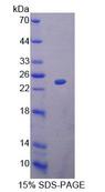 BM022 / MRPL1 Protein - Recombinant Mitochondrial Ribosomal Protein L1 By SDS-PAGE