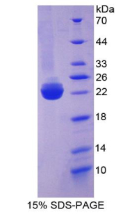 BMP3 Protein - Recombinant Bone Morphogenetic Protein 3 By SDS-PAGE