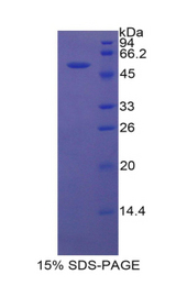 BRCA1 Protein - Recombinant Breast Cancer Susceptibility Protein 1 By SDS-PAGE
