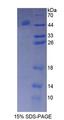BTK Protein - Recombinant  Bruton'S Tyrosine Kinase By SDS-PAGE
