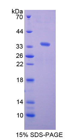 C1qRP / CD93 Protein - Recombinant  Complement Component 1, Q Receptor By SDS-PAGE