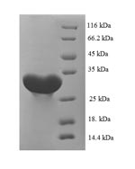 CA1 / Carbonic Anhydrase I Protein - (Tris-Glycine gel) Discontinuous SDS-PAGE (reduced) with 5% enrichment gel and 15% separation gel.