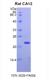 CA12 / Carbonic Anhydrase XII Protein - Recombinant Carbonic Anhydrase XII By SDS-PAGE