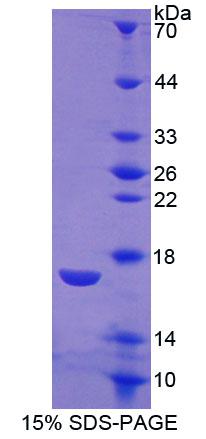 CALCR / Calcitonin Receptor Protein - Recombinant Calcitonin Receptor By SDS-PAGE