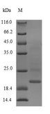 CALM1 / Calmodulin Protein - (Tris-Glycine gel) Discontinuous SDS-PAGE (reduced) with 5% enrichment gel and 15% separation gel.
