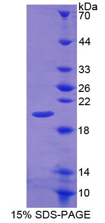 CALY Protein - Recombinant Calcyon Neuron Specific Vesicular Protein (CALY) by SDS-PAGE