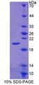 CALY Protein - Recombinant Calcyon Neuron Specific Vesicular Protein (CALY) by SDS-PAGE