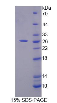 CAPN11 / Calpain 11 Protein - Recombinant Calpain 11 (CAPN11) by SDS-PAGE
