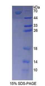 CARP / ANKRD1 Protein - Recombinant  Ankyrin Repeat Domain Protein 1 By SDS-PAGE